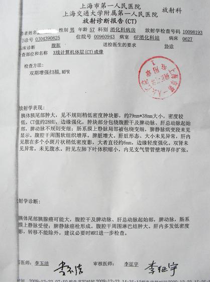 上海张先生服用rh2胰腺癌得到控制
