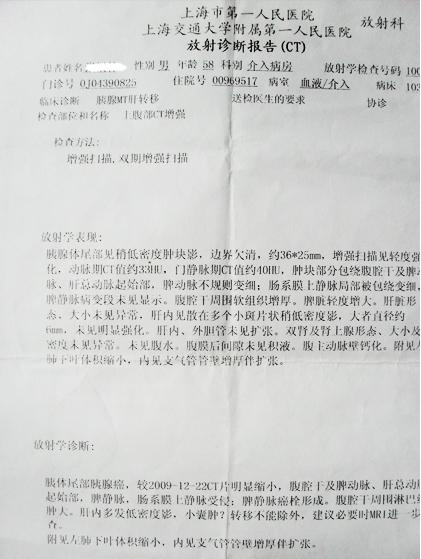 上海张先生服用rh2胰腺癌得到控制
